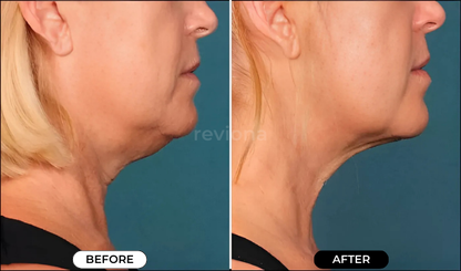 NeckLift Instant Tape