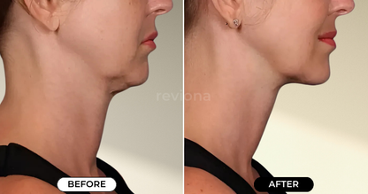 NeckLift Instant Tape