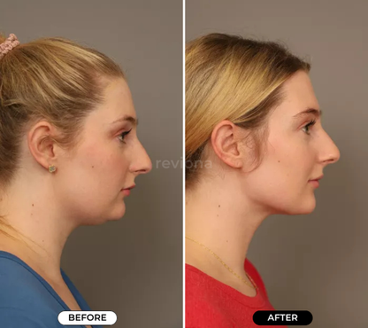 NeckLift Instant Tape