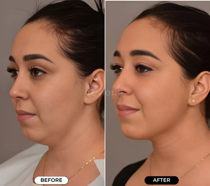 NeckLift Instant Tape