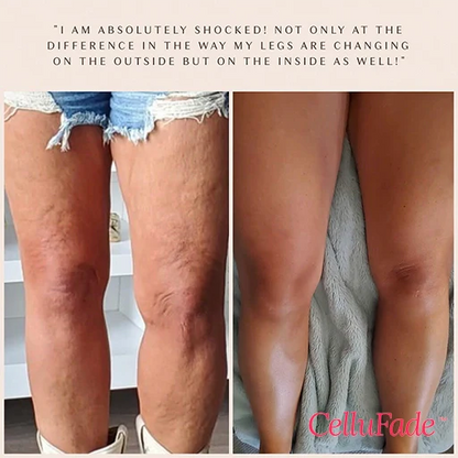 SmoothSkin Cellulite Roller