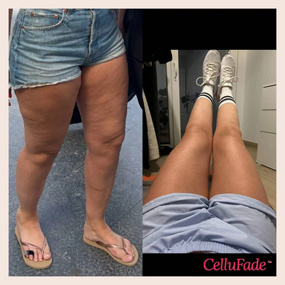 SmoothSkin Cellulite Roller